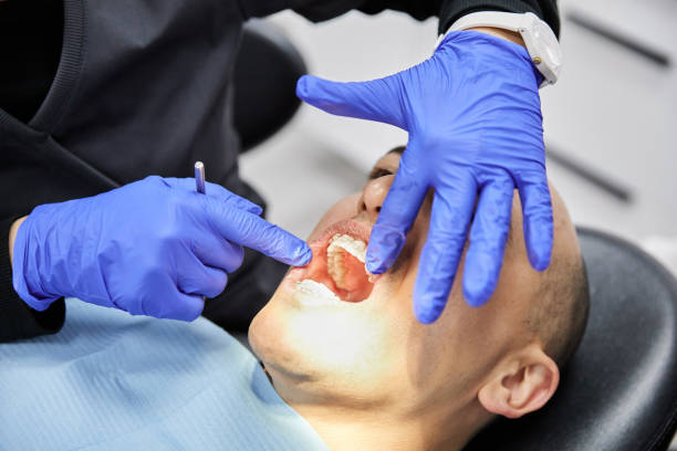 Best Teeth Whitening  in Pinehurst, TX